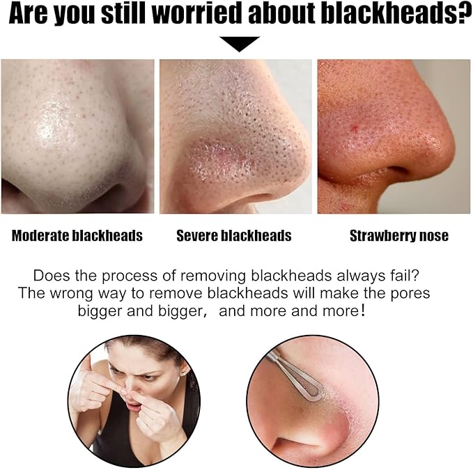 Nose Blackhead Strips